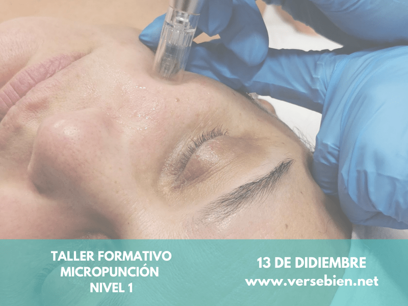 taller formativo micropunción valencia