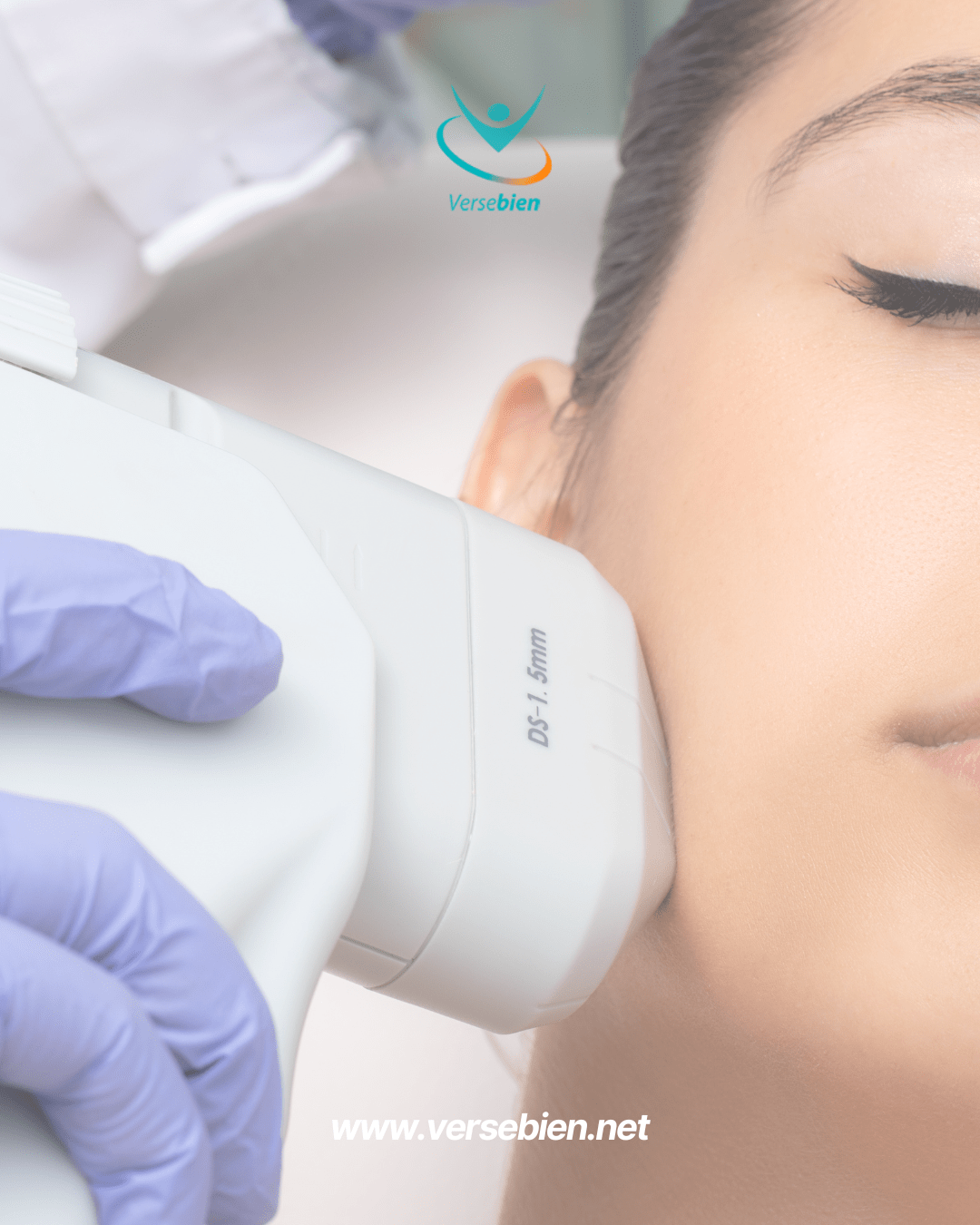HIFU facial: cómo ofrecer este tratamiento en tu centro sin comprar el equipo