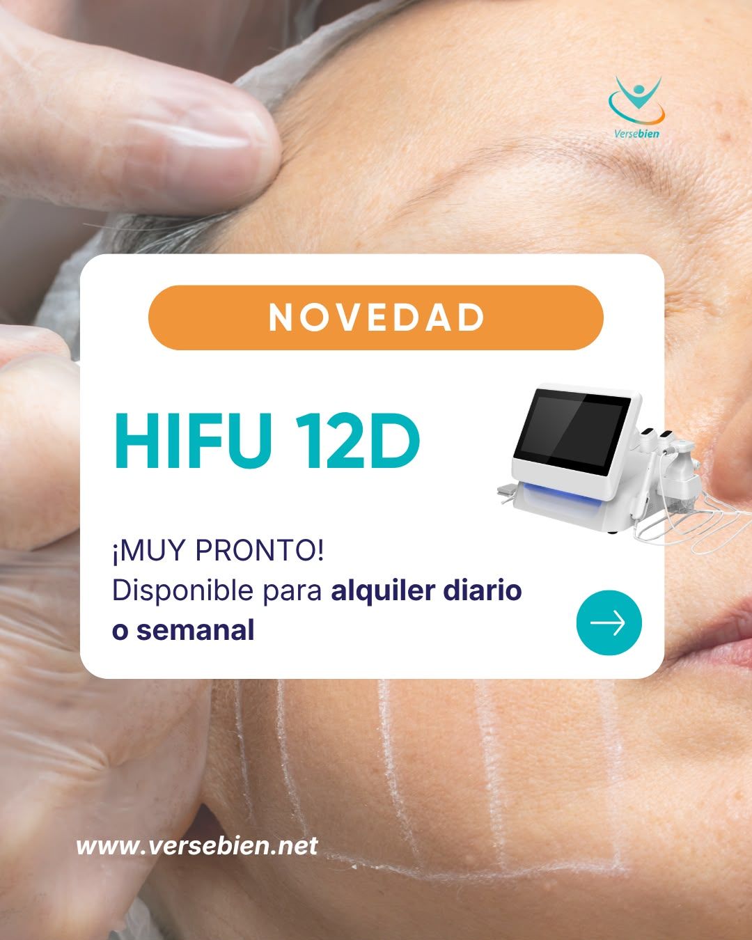 Nuevo HIFU 12D en alquiler en Valencia y Castellón